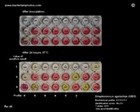 biochemical tests for identification of streptococcus agalactiae (GBS)